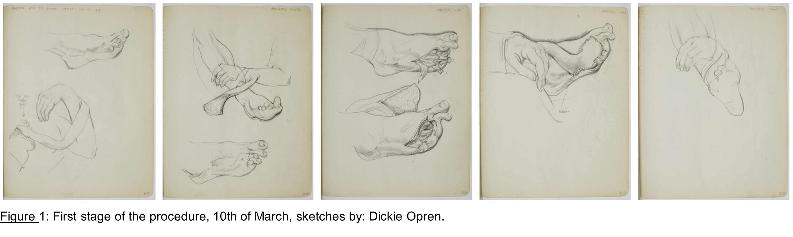 April bulletin figure 1